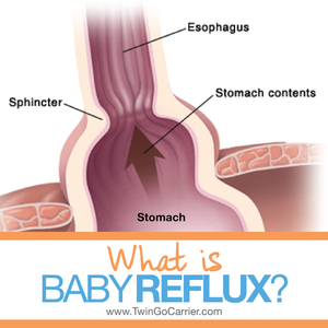 What is baby reflux?