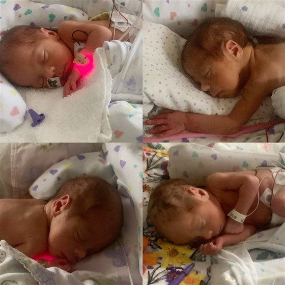 Rare identical quadruplet girls born in Minnesota!